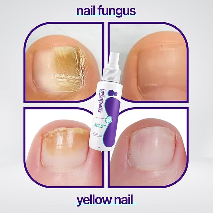 Nail Fungus Remover